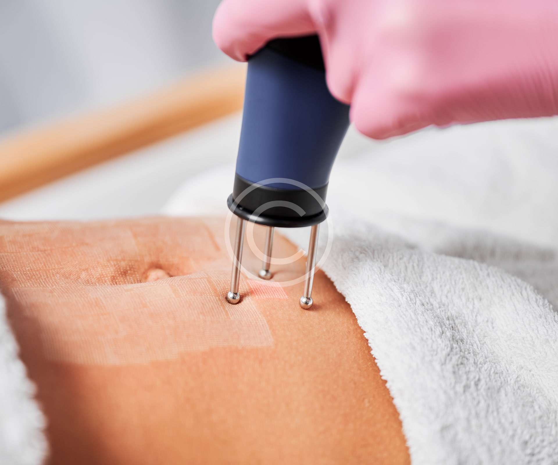 Skin renewal